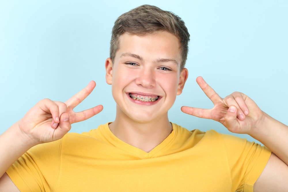 Young,Man,With,Dental,Braces,Showing,Two,Fingers,On,Blue