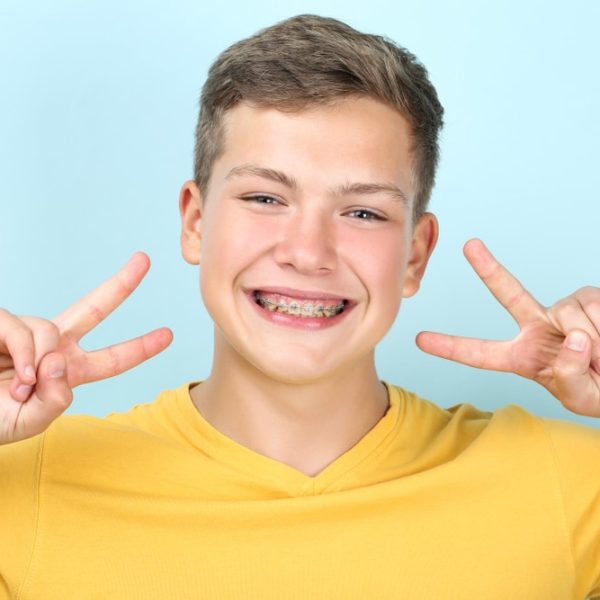 Young,Man,With,Dental,Braces,Showing,Two,Fingers,On,Blue